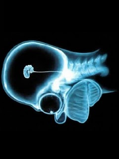 homer-simpson-wallpaper-brain-1024.jpg